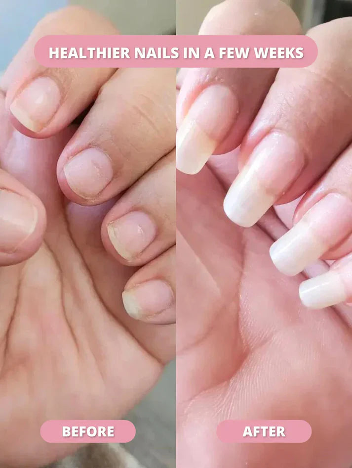 Vero & Co. Nail Growth Oil